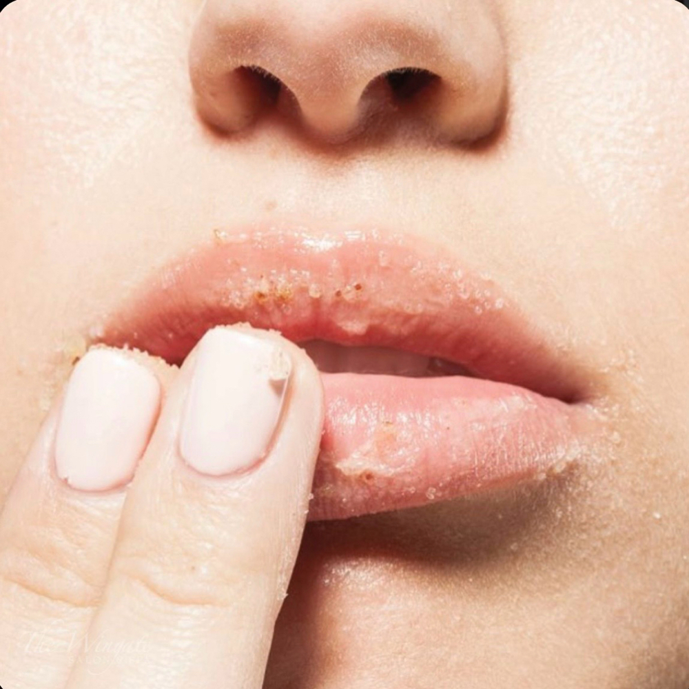 Lip Treatment Add-on at HisImage Esthetics in Loganville, GA