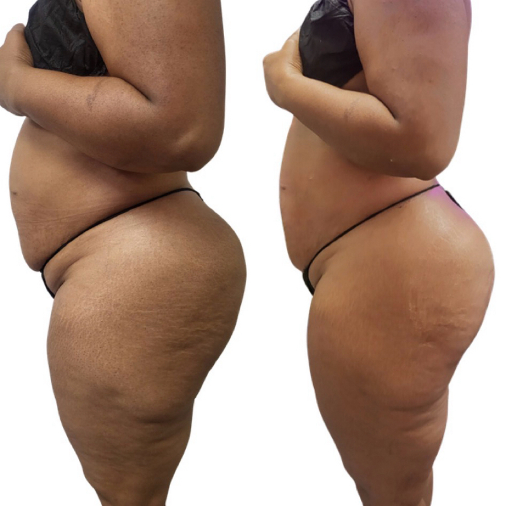 Summer Contour Model at Swani Massage and Bodywork in Fort Worth, TX