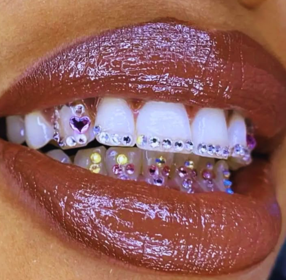 Teeth Gem Bling Out