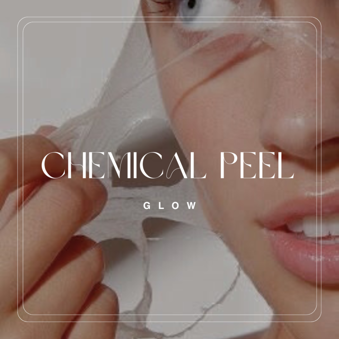 Chemical Peel Glow 🤍 at A GLOW in Metaire, LA