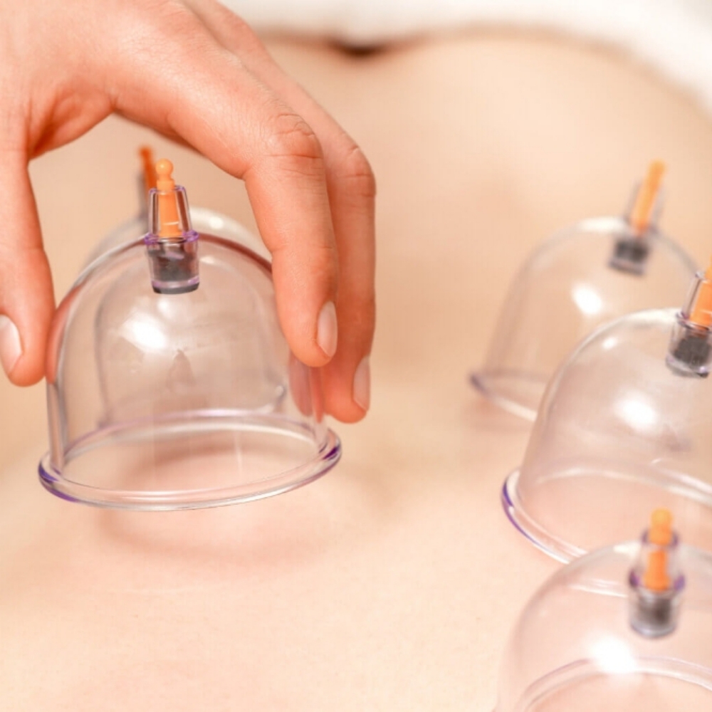 Cupping (Add-On ONLY) at Rooted Therapeutic Massage in Delta, UT