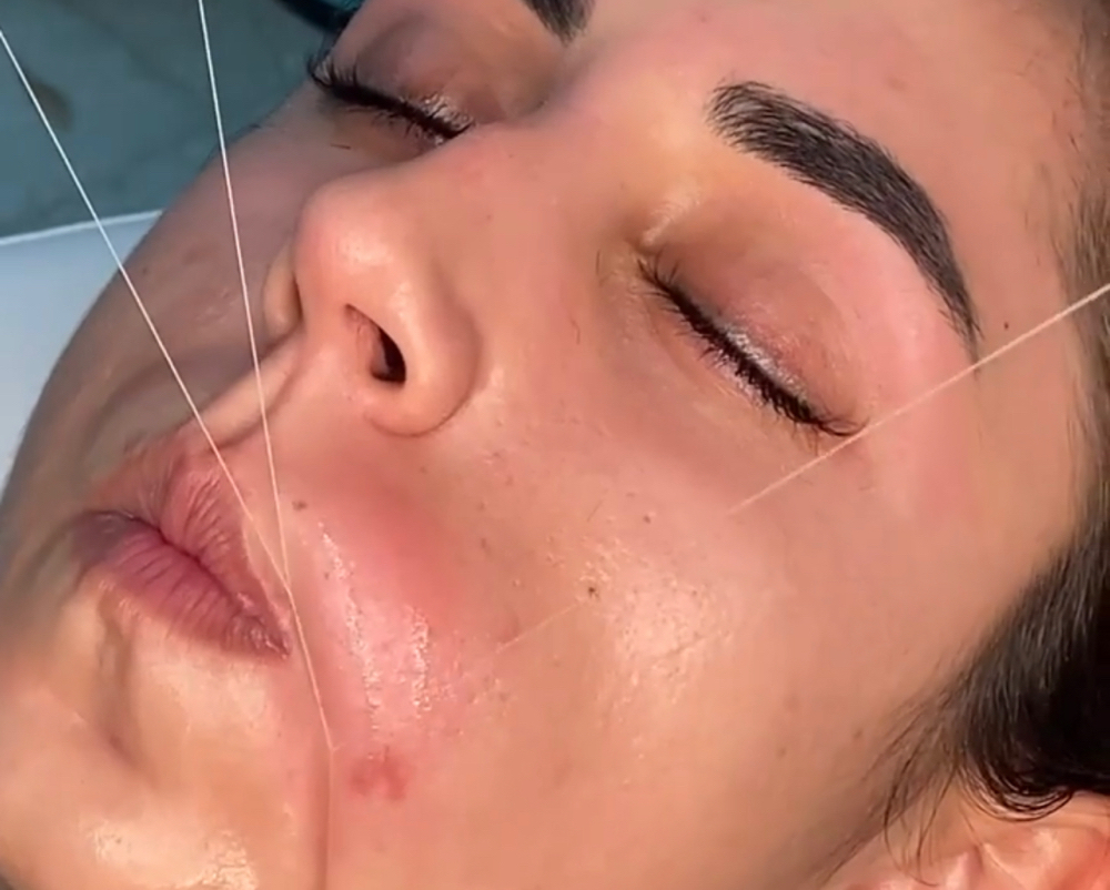 Upper Lip