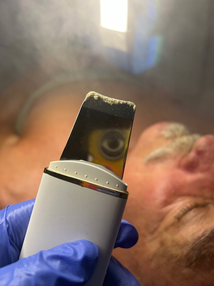 Mens Facial
