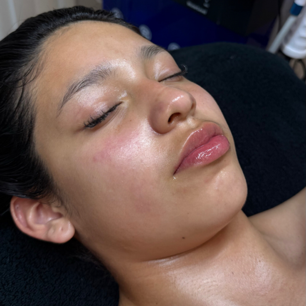 Facial Teenagers at Any Beauty Aesthetics Care in New York, NY