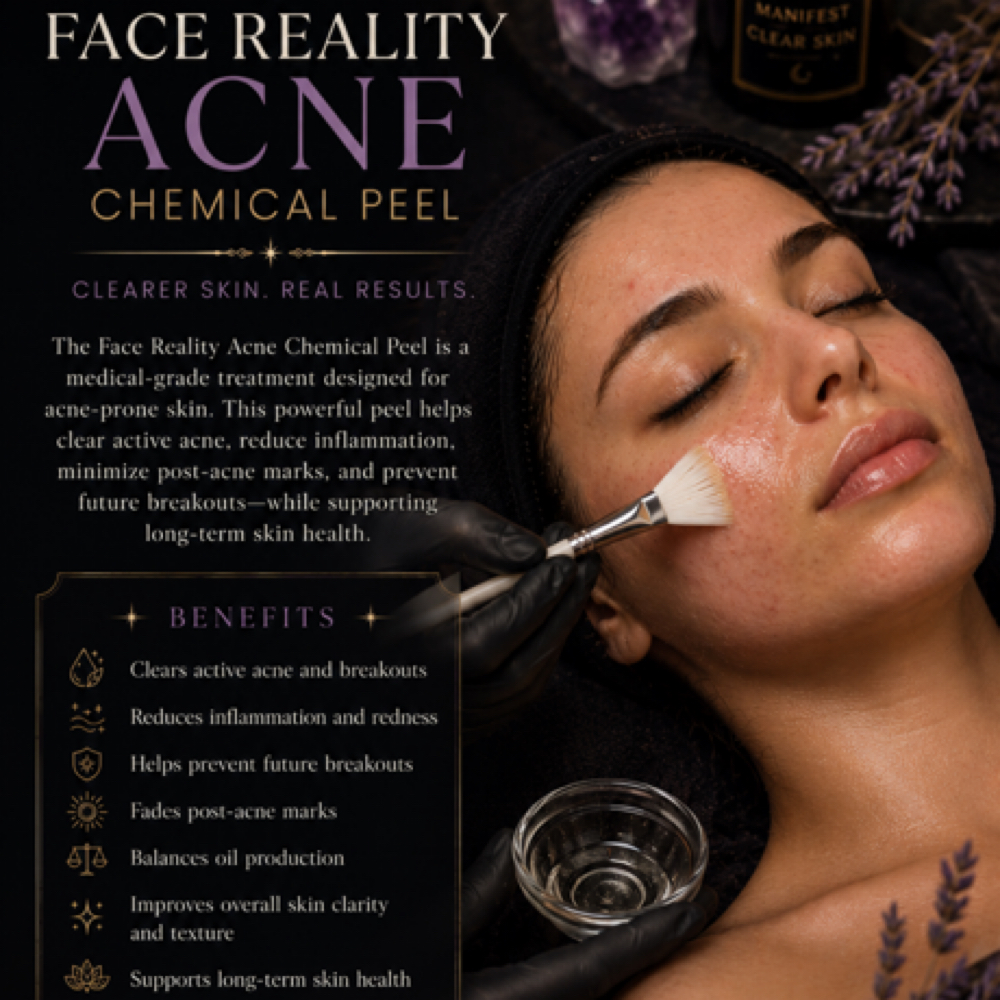 Face Reality Acne Chemical Peel at The Skin Apothecary in Baytown, TX