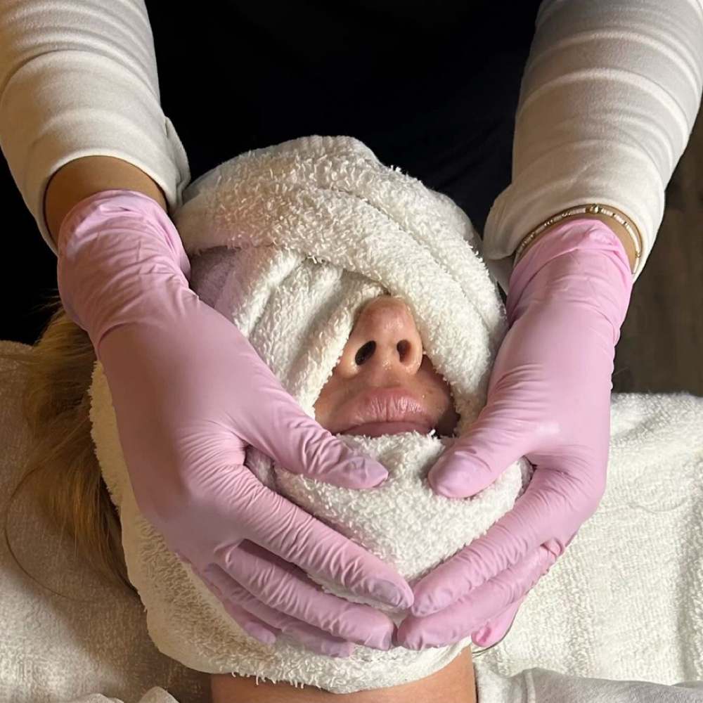 Acne Treatment Facial