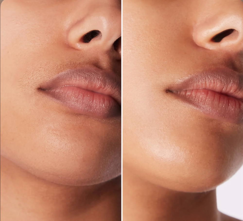 Upper Lip Wax
