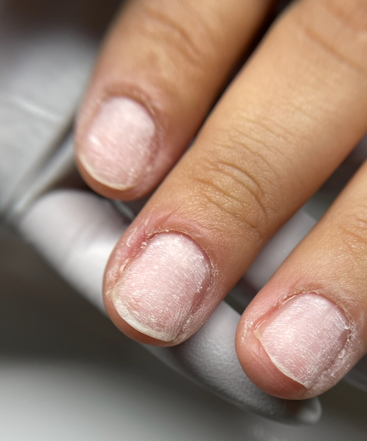 Gel Removal/ Nail Fix