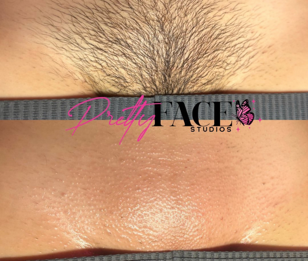 Brazilian Wax