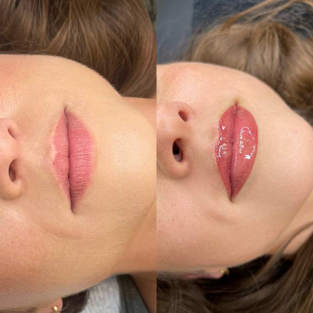 Lip Blushing