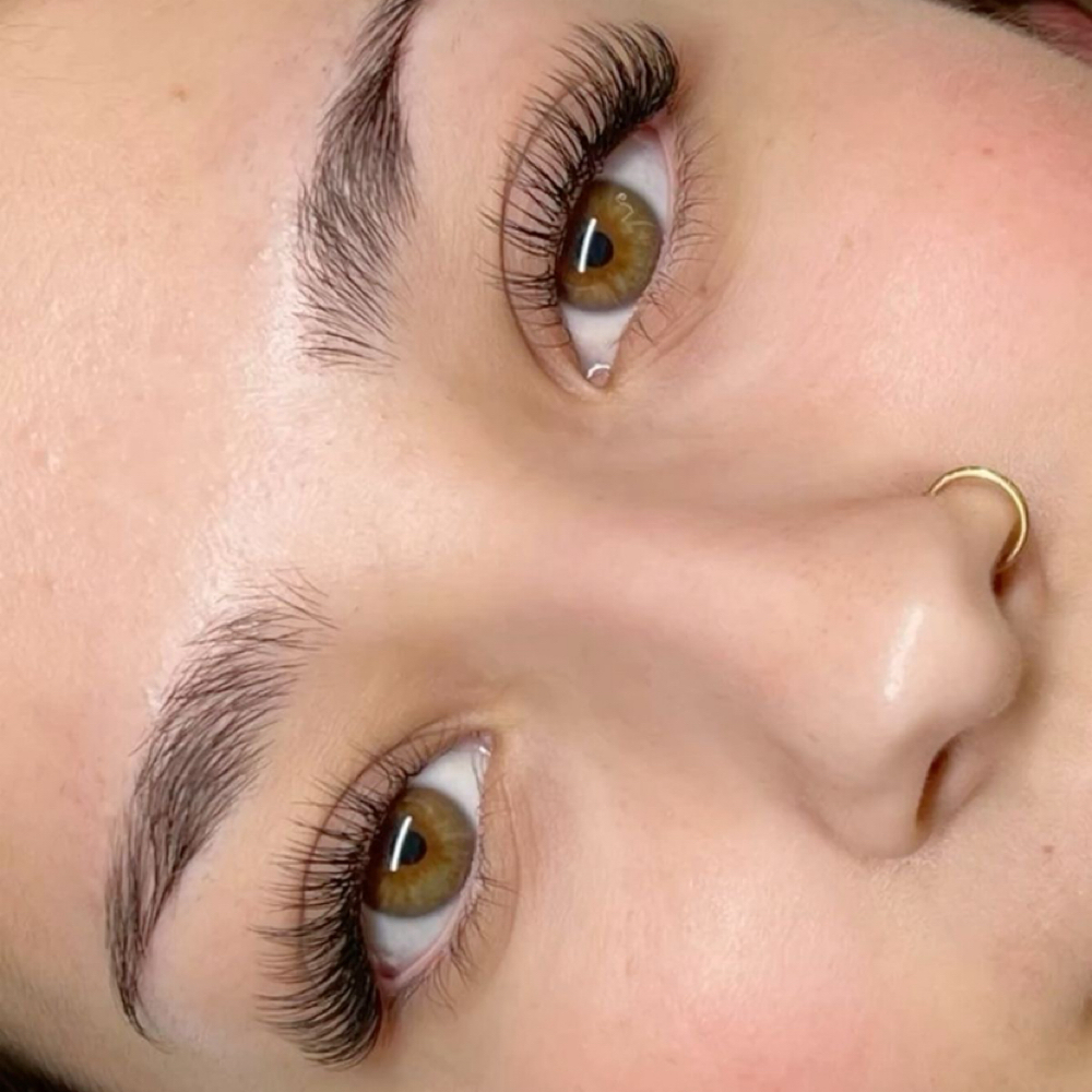 Classic 2 Week Fill at Nude Skin Aesthetics in San Pedro, CA