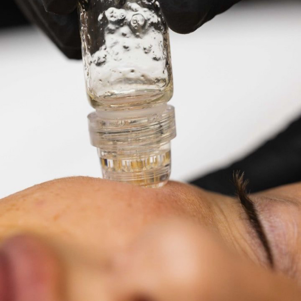 Procell Microchanneling at B.E. Aesthetics in Port Saint Lucie, FL