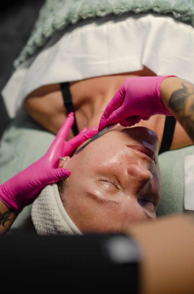 Dermaplaning Skincare Treatment
