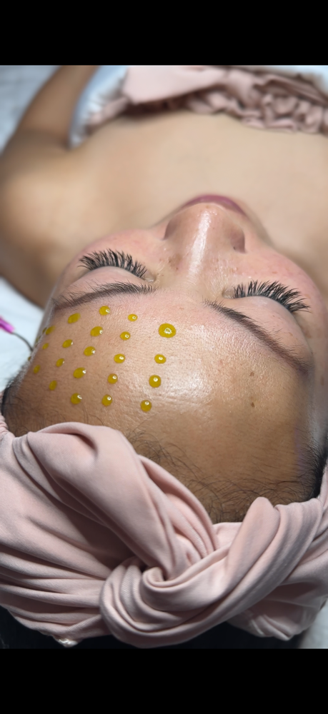 BioRePeel • Dermaplaning • LED