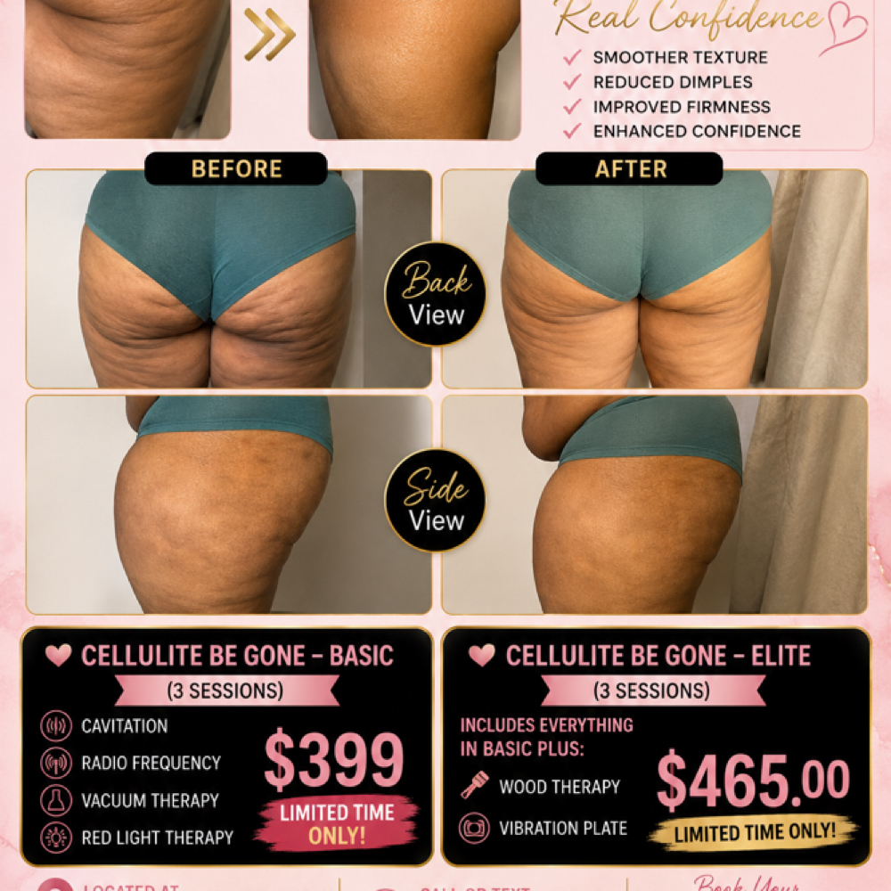 Cellulite be Gone at De Colores Beauty Bar in Chicago, IL