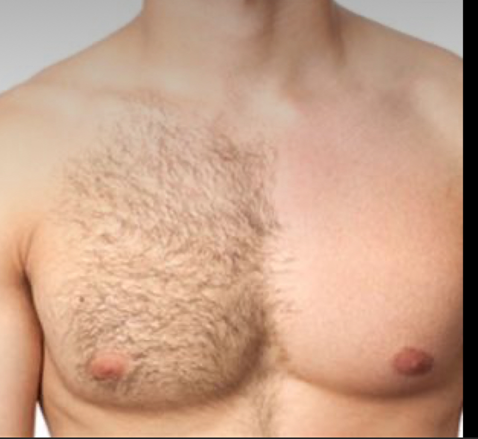 Chest Wax