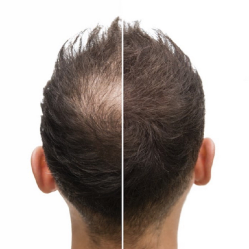 SMP Scalp Micro-Pigmentation - Jay at Heartbreak Nail Club in Asheville, NC