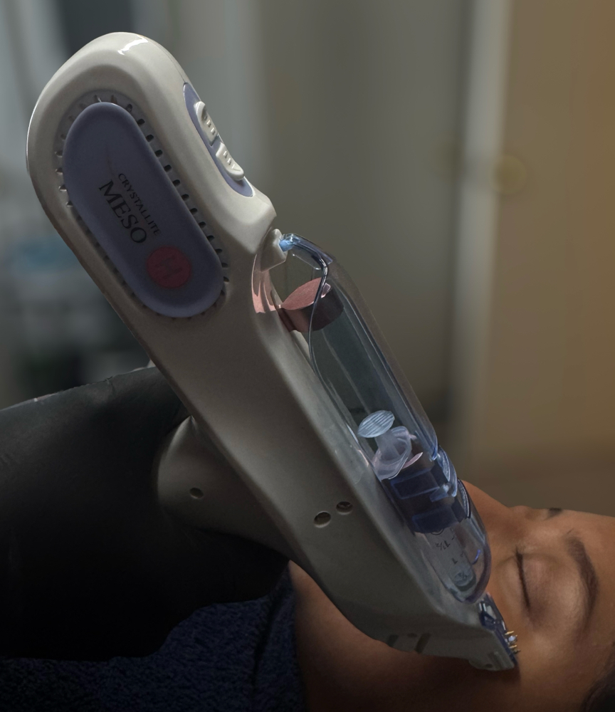 Microcristaline Facial at Zoraya Velez AESTHETICIAN in Richmond, VA
