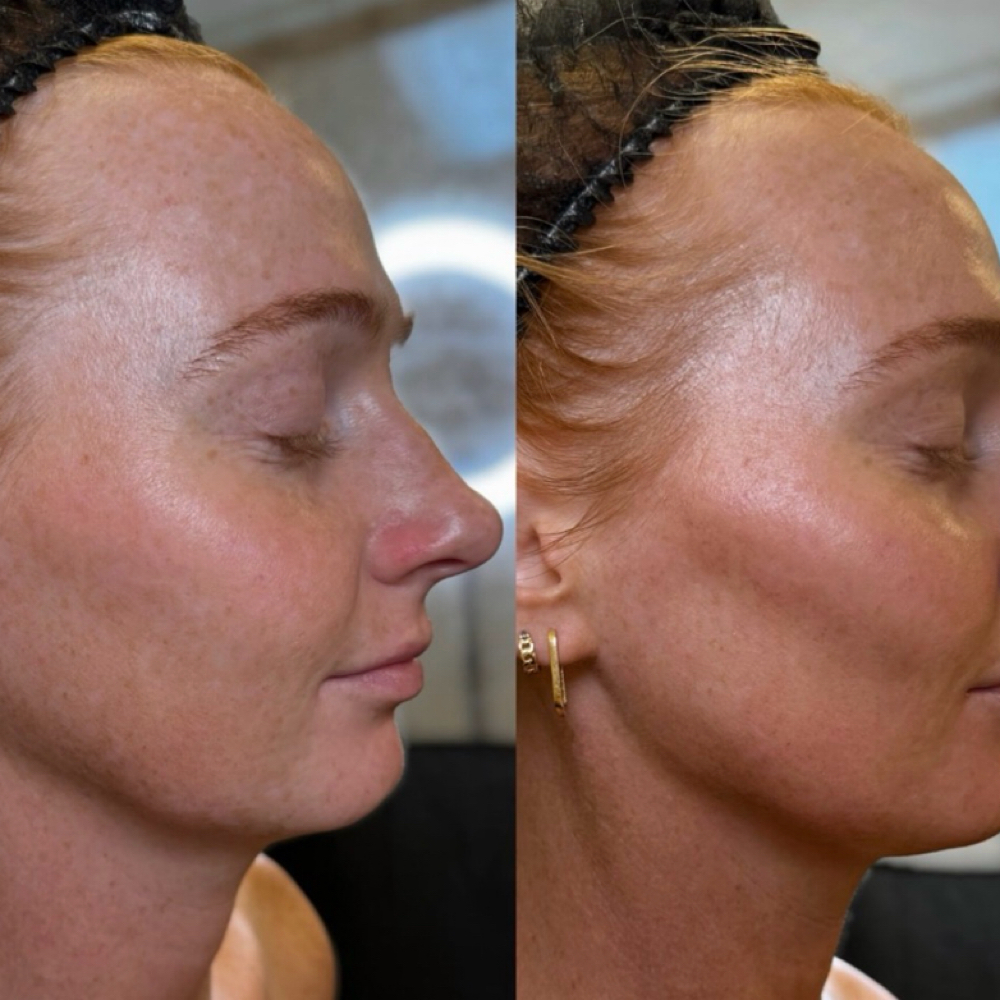 Contour Spray Tan at Smooth Esthetics Skin Lounge in Grand Island, NE