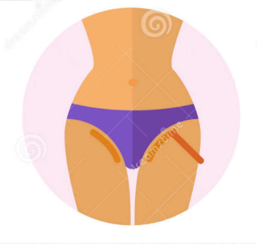 Bikini or Lower Belly