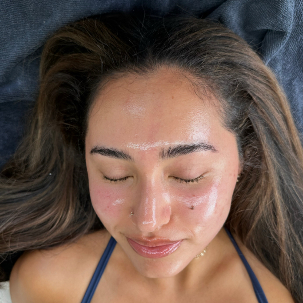 90 Day Dermal Transformation at Lucid Theorem in Atlanta, GA