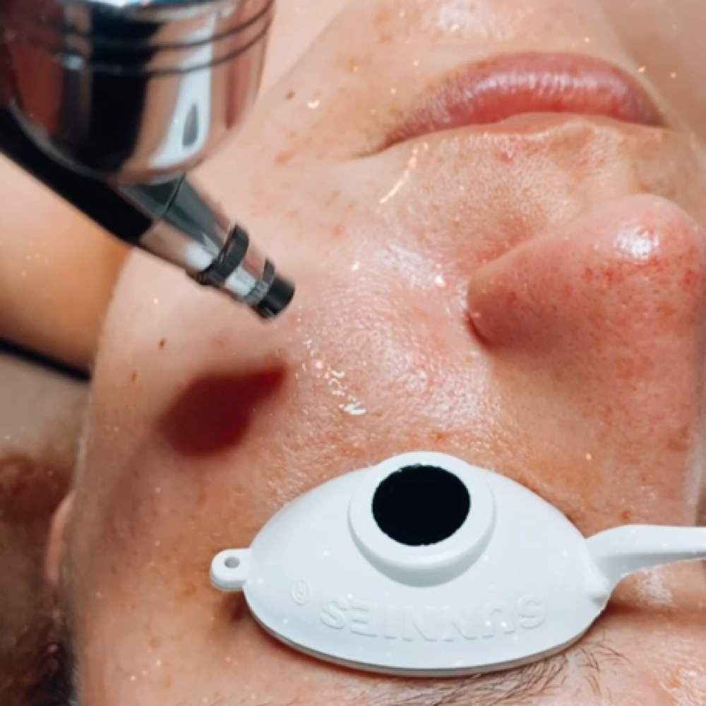 OxyHy Facial at The Skin Co. in Orange, CA