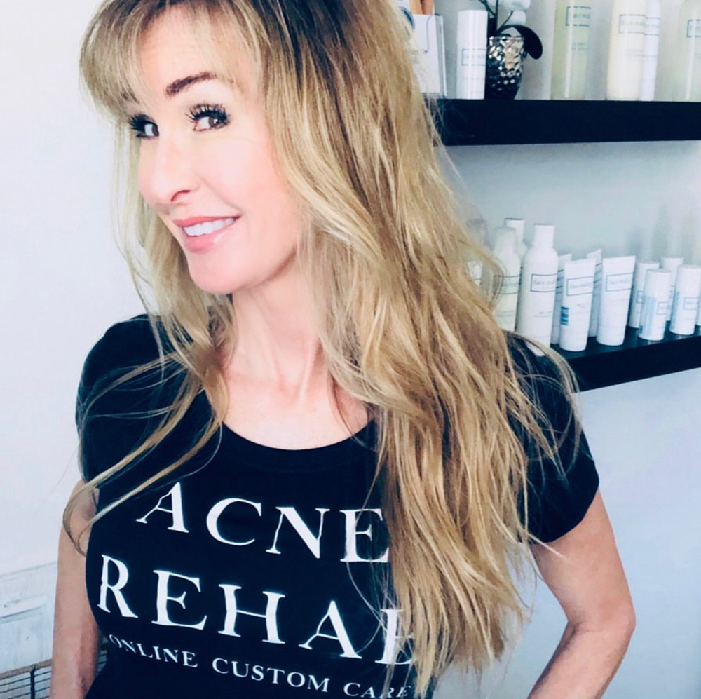 Acne facial 45 Minutes at Oasis Spa @ Ironwolf in Lake Havasu City, AZ