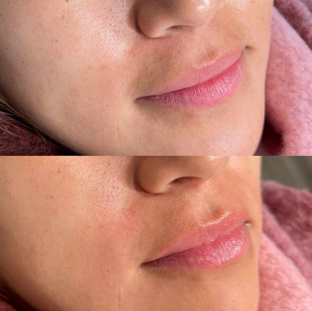 Upper Lip Wax at Leticia  Muller in San Mateo, CA