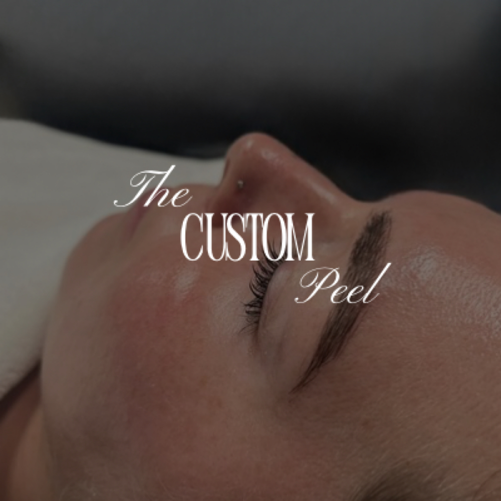 Custom Chemical Peel at Laney Beth Beauty in Franklin, TN