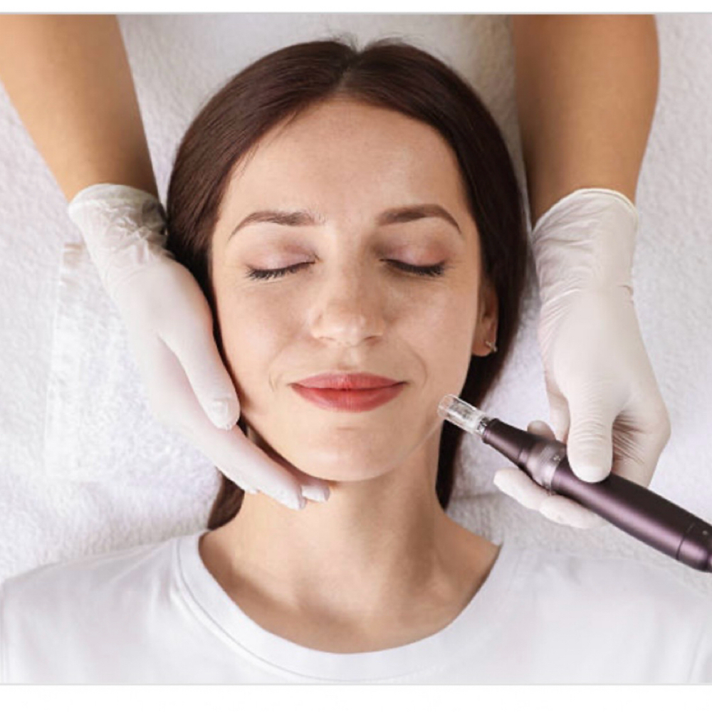 Nano-Needling Skin Infusion: 75-Min at BeautybyBrogan in Winter Springs, FL