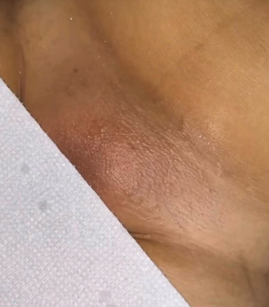 Brazilian  Wax 4-6 Weeks Of Growth