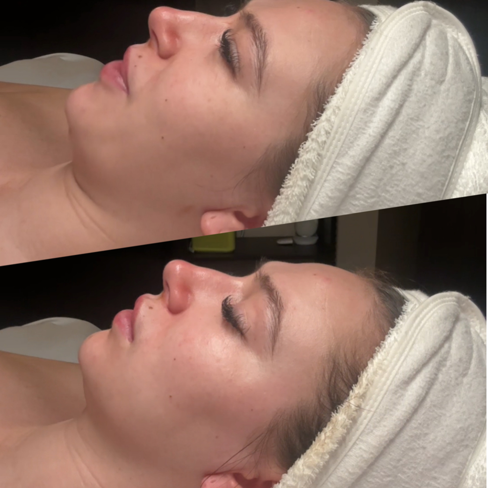 The Instant SCULPT FACIAL at Face Integrity in Fort Worth, TX