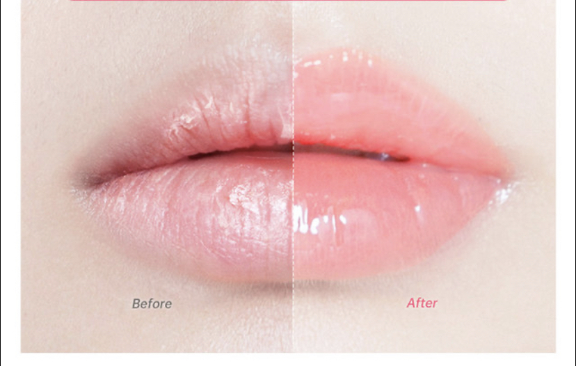 Hydrating Lip Treatmen& Exfoliation