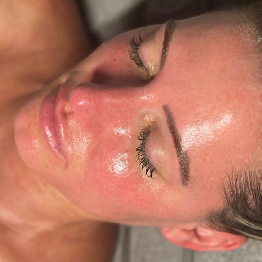 FIRE & ICE FACIAL at Here She Glows Spa in Agoura Hills, CA