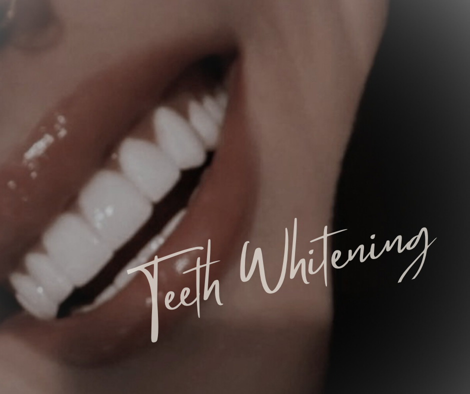 Teeth Whitening