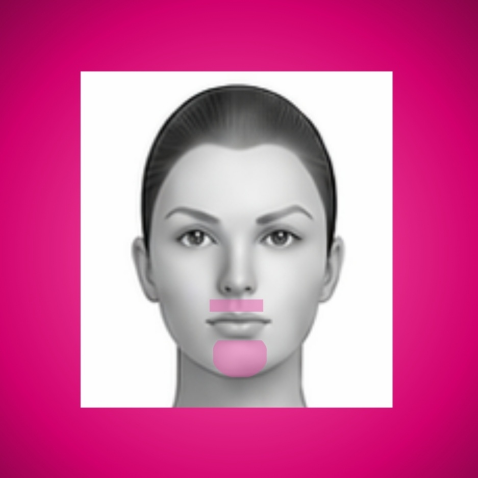 Buy 3 + 1 Free - Small Area at Silk Lasers in Winter Park, FL
