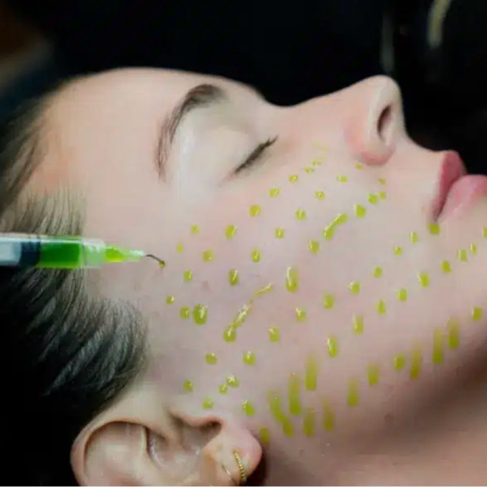 Bio Repeel at Nkd Beauty Esthetics in Pearland, TX