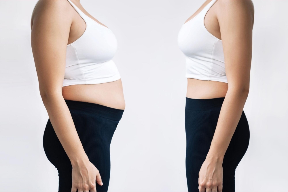 Weight Loss Medication