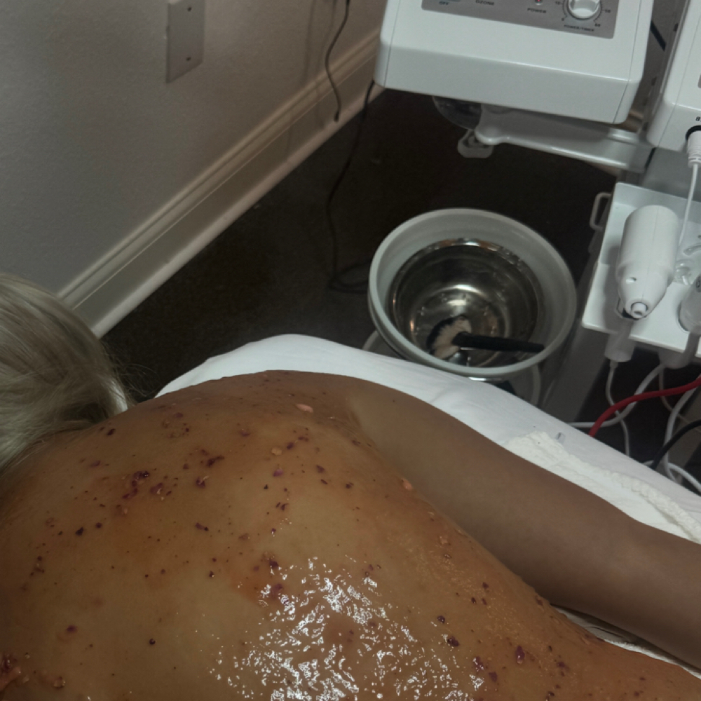 Back Facial (Room #1) at Competitive Edge Massage and Wellness in Auburndale, FL