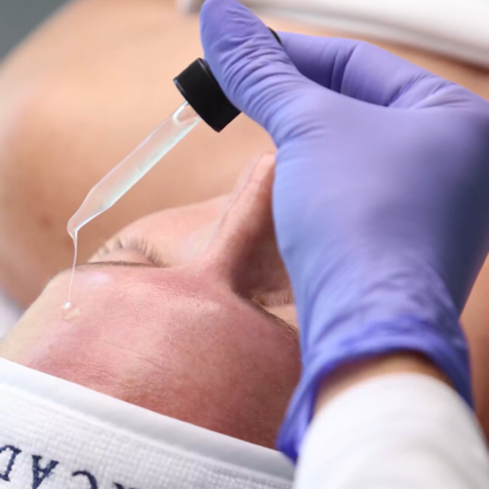 Acne Extraction & Relief Facial at Yadis Nails & Spa Laser in Austin, TX