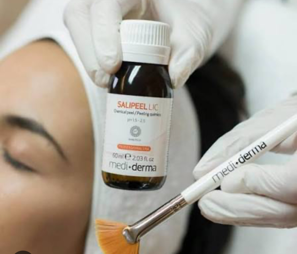 Facial Peeling Salipeel at Selflovebyely in Ocala, FL
