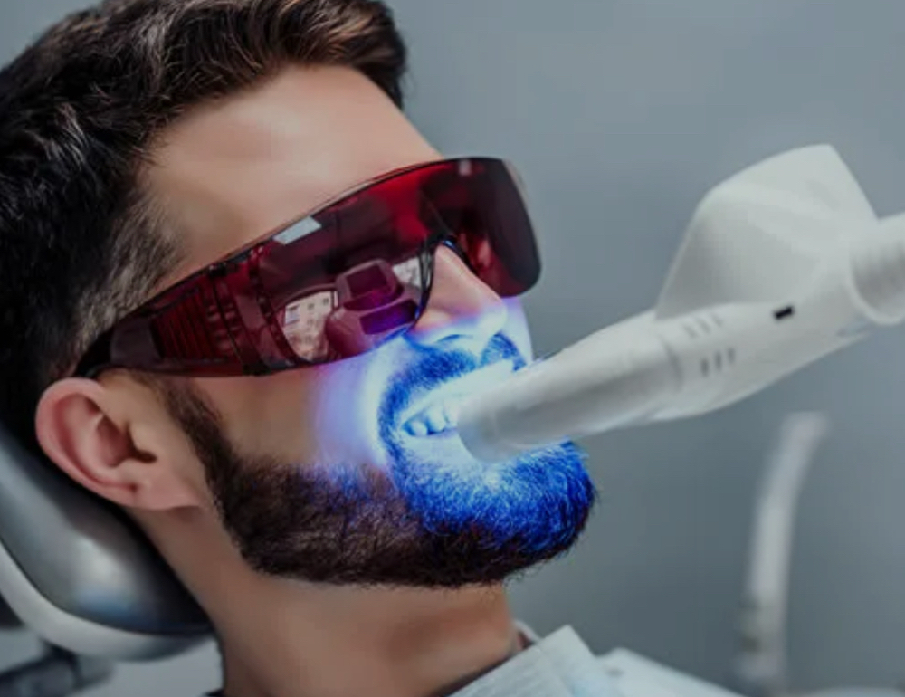 Teeth Whitening at NAIKED ESTHETICS BY NAOMI in TUCSON, AZ