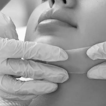 Chin at Touch of faith esthetics in Somerset, NJ
