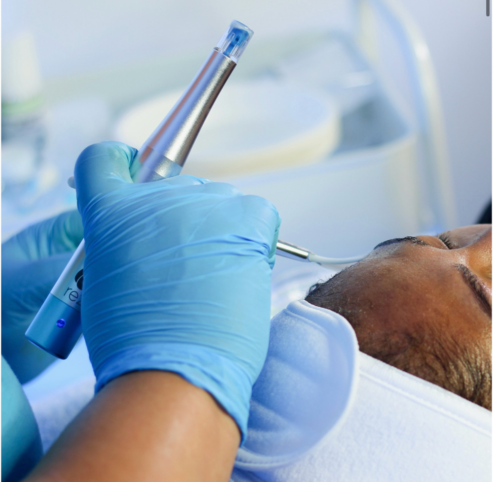 Resurfacing Nano Needling Glow