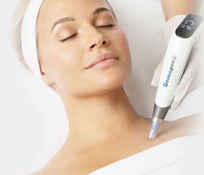 Microneedeling