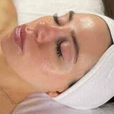 Glymed Peptide Peel + Dermaplane