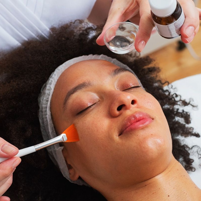 Advanced Chemical Peel at Skincare Factory in Tempe, AZ
