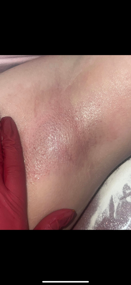 Under Arms at Kenzie Painter in Boaz, AL