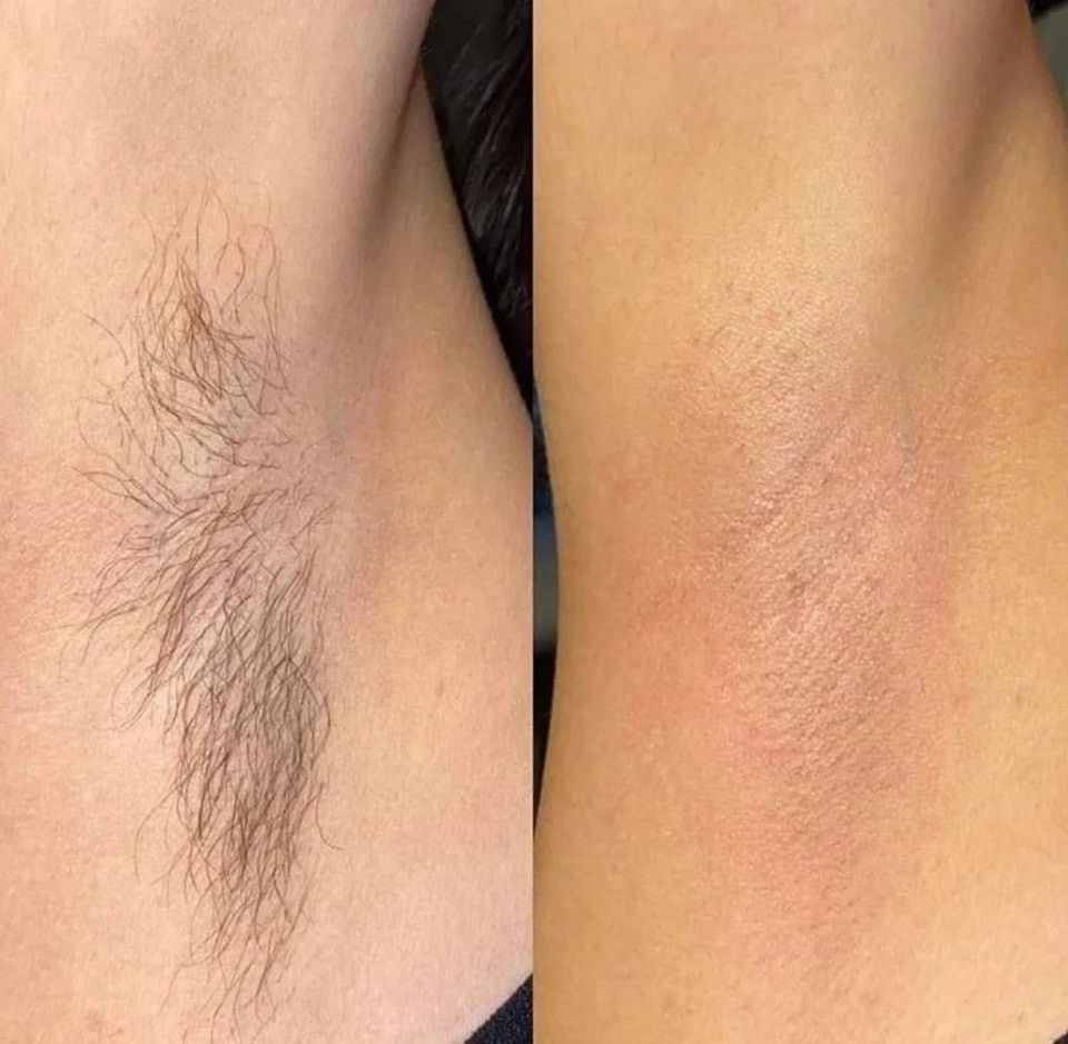 Armpit wax
