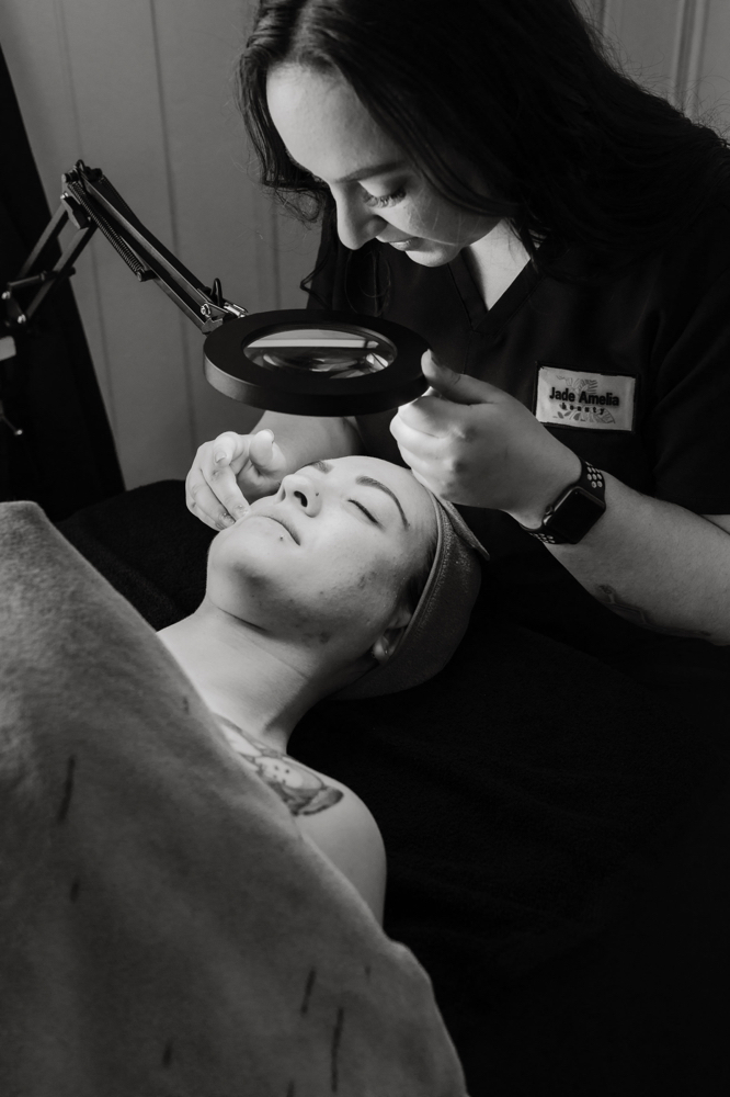 Skin Consultation